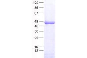Image no. 1 for RAD51 Homolog B (Rad51B) protein (His tag) (ABIN2730413)