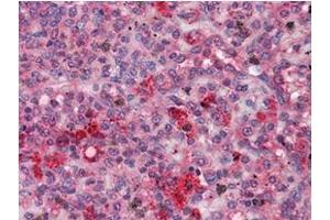 Image no. 1 for anti-Gardner-Rasheed Feline Sarcoma Viral (V-Fgr) Oncogene Homolog (FGR) antibody (ABIN1107221)