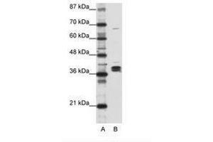 Image no. 1 for anti-Heterogeneous Nuclear Ribonucleoprotein D-Like (HNRPDL) (AA 119-168) antibody (ABIN203083)