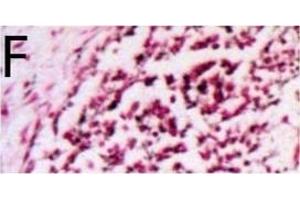 Image no. 7 for anti-Microphthalmia-Associated Transcription Factor (MITF) antibody (ABIN676373)