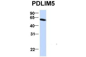 Image no. 7 for anti-PDZ and LIM Domain 5 (PDLIM5) (N-Term) antibody (ABIN2780775)