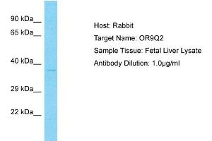 Image no. 1 for anti-Olfactory Receptor, Family 9, Subfamily Q, Member 2 (OR9Q2) (C-Term) antibody (ABIN2791800)