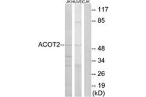 Image no. 1 for anti-Acyl-CoA Thioesterase 2 (ACOT2) (AA 171-220) antibody (ABIN1534599)