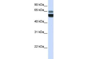 Image no. 1 for anti-Sphingomyelin phosphodiesterase 1, Acid Lysosomal (SMPD1) (Middle Region) antibody (ABIN2776371)
