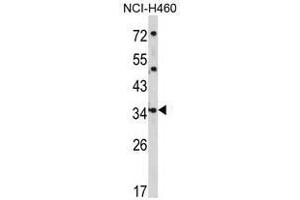 Image no. 1 for anti-Cerberus 1 Homolog (Xenopus Laevis) (CER1) (N-Term) antibody (ABIN452837)