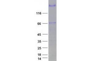 Image no. 1 for Pregnancy-Associated Plasma Protein A, Pappalysin 1 (PAPPA) protein (Myc-DYKDDDDK Tag) (ABIN2728213)