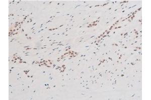 Image no. 16 for anti-Spleen tyrosine Kinase (SYK) (pTyr348) antibody (ABIN6255895)