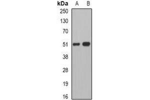 Image no. 1 for anti-Pancreatic Lipase (PNLIP) (full length) antibody (ABIN6005352)