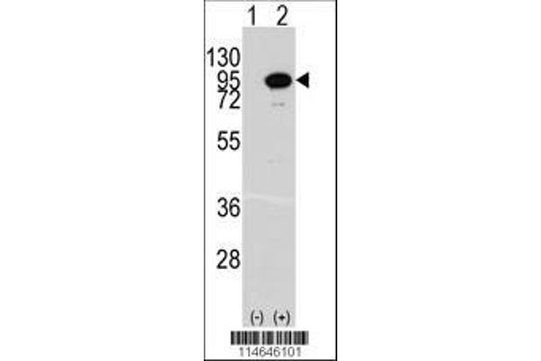anti-Aconitase 2, Mitochondrial (ACO2) (AA 294-325) antibody