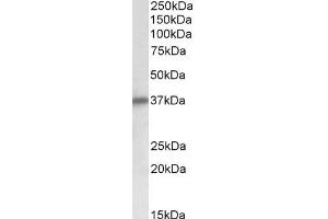 Image no. 2 for anti-Sarcoglycan, delta (35kDa Dystrophin-Associated Glycoprotein) (SGCD) (AA 245-257) antibody (ABIN5539715)