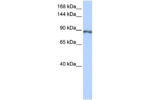 Image no. 1 for anti-Small Optic Lobes Homolog (SOLH) (Middle Region) antibody (ABIN2780697)