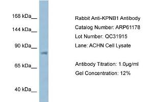 Image no. 1 for anti-Karyopherin (Importin) beta 1 (KPNB1) (N-Term) antibody (ABIN2788708)