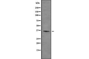 Image no. 1 for anti-ZFP36 Ring Finger Protein-Like 1 (ZFP36L1) antibody (ABIN6265589)