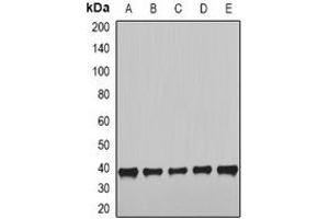 Image no. 2 for anti-NudE Neurodevelopment Protein 1 (NDE1) antibody (ABIN3197744)
