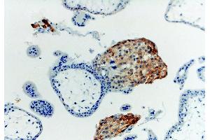 Image no. 2 for anti-HLA Class I Histocompatibility Antigen, alpha Chain G (HLAG) antibody (Biotin) (ABIN94367)