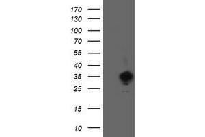 Image no. 1 for anti-Sulfotransferase Family, Cytosolic, 1C, Member 2 (SULT1C2) antibody (ABIN1501234)