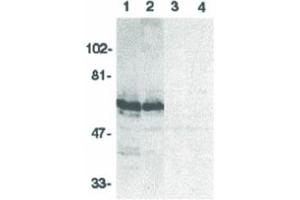 Image no. 3 for anti-BCL2-Associated Athanogene 4 (BAG4) (N-Term) antibody (ABIN6656636)