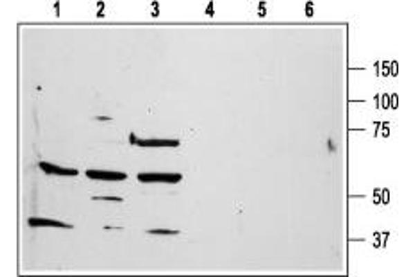 PAR1 antibody  (Extracellular, N-Term)