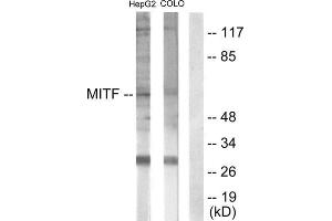 Image no. 4 for anti-Microphthalmia-Associated Transcription Factor (MITF) (Ser180), (Ser73) antibody (ABIN1847958)