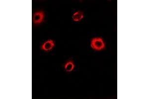 Image no. 1 for anti-Eukaryotic Translation Initiation Factor 4A1 (EIF4A1) (full length) antibody (ABIN6005086)