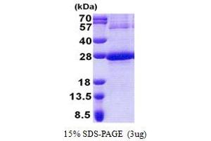 NADH Dehydrogenase (Ubiquinone) 1 beta Subcomplex, 9, 22kDa (NDUFB9) (AA 1-179) protein (His tag)