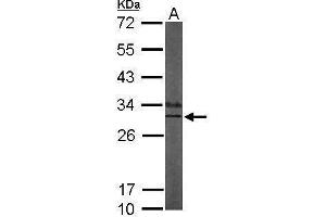 Image no. 1 for anti-Kv Channel Interacting Protein 3, Calsenilin (KCNIP3) (Center) antibody (ABIN2856215)