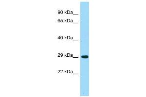 Image no. 1 for anti-Alkaline Ceramidase 2 (ACER2) (Middle Region) antibody (ABIN2790349)