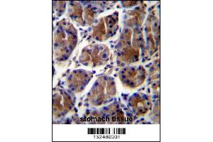 Image no. 3 for anti-Gastric Intrinsic Factor (Vitamin B Synthesis) (GIF) (AA 189-218) antibody (ABIN656899)