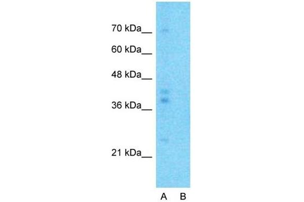 G6PC antibody  (N-Term)