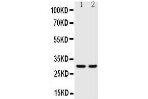 Image no. 2 for anti-Kallikrein 1 (KLK1) (AA 243-261), (C-Term) antibody (ABIN3043136)