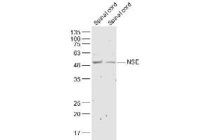 Image no. 4 for anti-Enolase 2 (Gamma, Neuronal) (ENO2) (AA 201-300) antibody (ABIN736581)