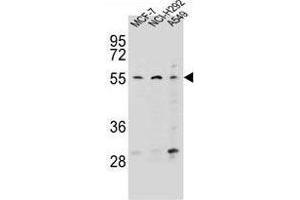 Image no. 1 for anti-Zinc Finger Protein 117 (ZNF117) (AA 12-41), (N-Term) antibody (ABIN955678)