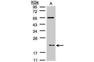Image no. 2 for anti-Actin Related Protein 2/3 Complex, Subunit 3, 21kDa (ARPC3) (Center) antibody (ABIN2855247)
