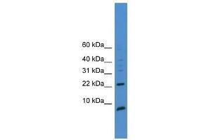 Image no. 1 for anti-Prostate Stem Cell Antigen (PSCA) (C-Term) antibody (ABIN927989)