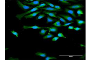 Immunofluorescence of purified MaxPab antibody to CAPN1 on HeLa cell.