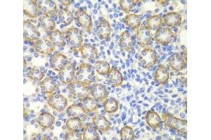 Immunohistochemistry of paraffin-embedded Rat kidney using SYT1 Polyclonal Antibody at dilution of 1:200 (40x lens).