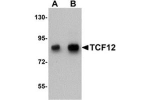 Image no. 1 for anti-Transcription Factor 12 (TCF12) (N-Term) antibody (ABIN783743)