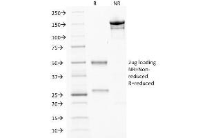 Image no. 1 for anti-Caudal Type Homeobox 2 (CDX2) antibody (ABIN6939058)
