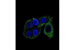 Image no. 3 for anti-Cytochrome P450, Family 2, Subfamily S, Polypeptide 1 (CYP2S1) (AA 406-436), (C-Term) antibody (ABIN951784)
