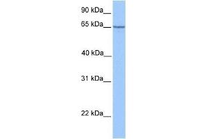Image no. 3 for anti-Promyelocytic Leukemia (PML) (C-Term) antibody (ABIN927422)