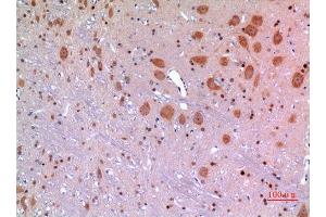 Image no. 3 for anti-Mesencephalic Astrocyte-Derived Neurotrophic Factor (MANF) (Internal Region) antibody (ABIN3187826)