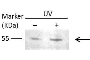WB Image Sample (30 ug of whole cell lysate) A: Raji 10% SDS PAGE antibody diluted at 1:1000
