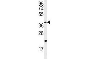 Image no. 5 for anti-Caspase 9, Apoptosis-Related Cysteine Peptidase (CASP9) (Ser196) antibody (ABIN3030322)