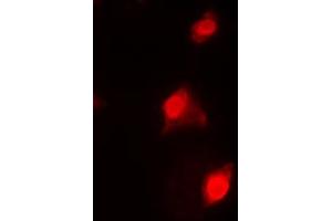Image no. 1 for anti-DNA Repair Protein RAD51 Homolog 3 (RAD51C) (Center) antibody (ABIN2706919)