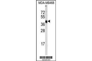 Image no. 1 for anti-Lysyl Oxidase (LOX) antibody (ABIN2444945)