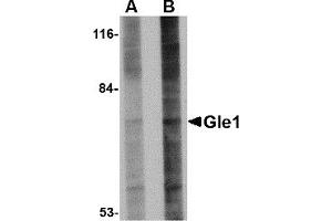 Western Blotting (WB) image for anti-GLE1 RNA Export Mediator (GLE1) (Middle Region) antibody (ABIN1030940)