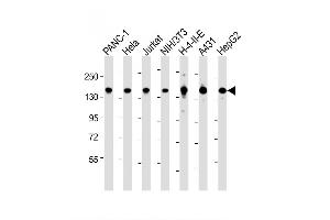 Image no. 3 for anti-Splicing Factor 3b, Subunit 1, 155kDa (SF3B1) (AA 374-402), (N-Term) antibody (ABIN657676)