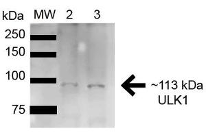 Image no. 3 for anti-Unc-51 Like Kinase 1 (ULK1) (AA 567-577) antibody (HRP) (ABIN5066150)