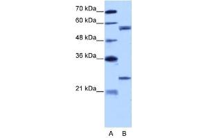 Image no. 2 for anti-Copine I (CPNE1) (N-Term) antibody (ABIN629980)