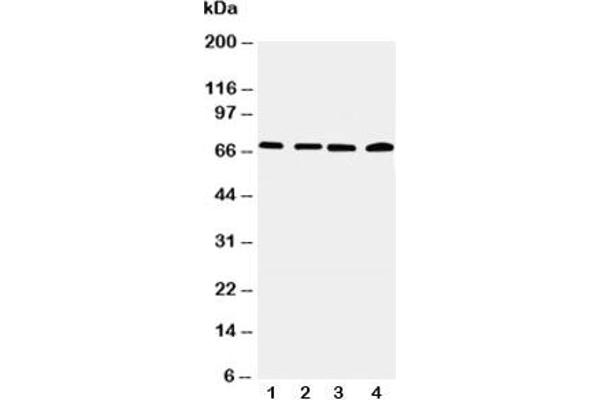 IRAK2 Antikörper  (C-Term)